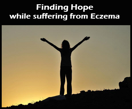 Finding_Hope_With_Eczema